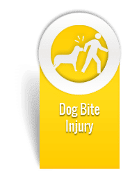 dog bite settlement san diego attorney